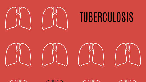 Getty Images Illustration of TB